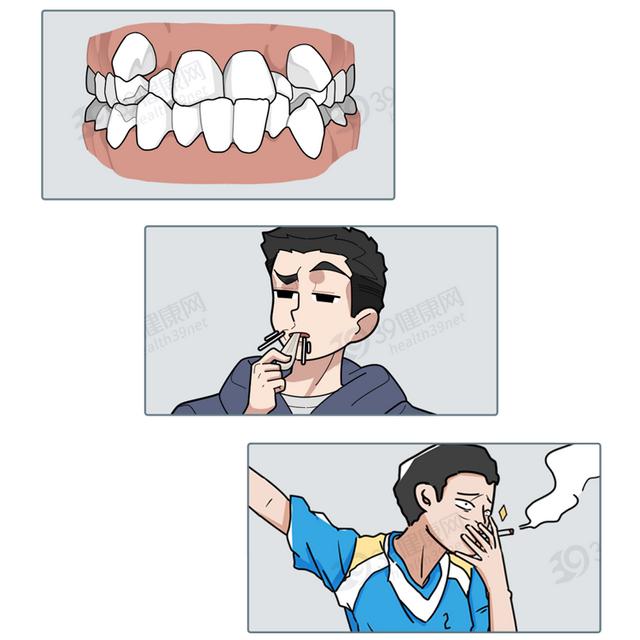 去除牙石简单的方法？教你去除牙石的3种方法